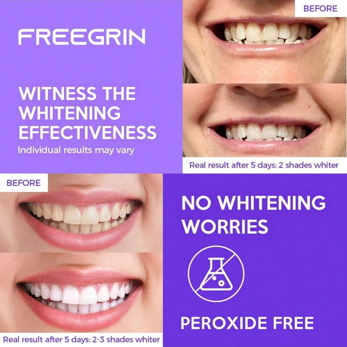 Deluxe Whitening Teeth Sticker - Home Fragrance Gel recension och pris
